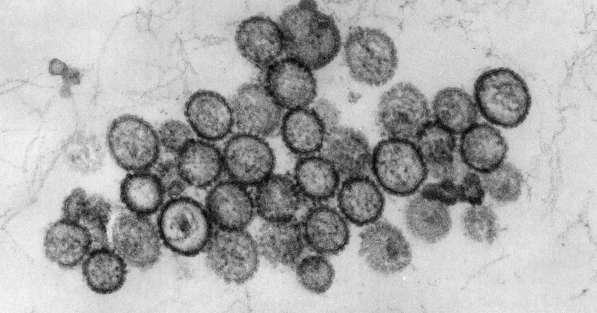 Hantavirus: Drei Tote auf Kreuzfahrtschiff im Atlantik